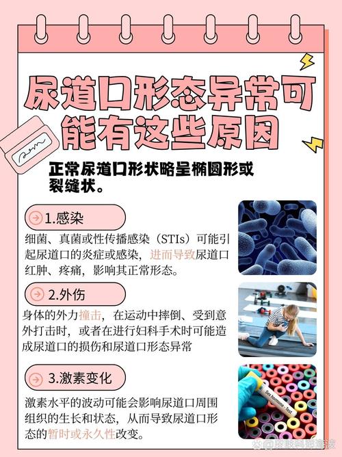 女性肛门有黄黄的分泌物的相关介绍