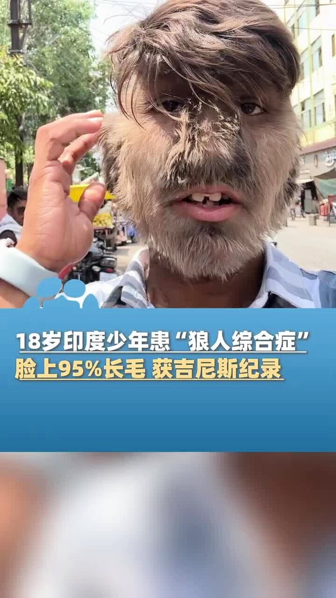 久久欧美一区二区三区的相关介绍